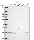 Western blot analysis in human cell line RT-4, human cell line U-251 MG, human plasma, human liver tissue and human tonsil tissue.