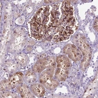 Immunohistochemical staining of human kidney shows strong cytoplasmic positivity in cells in glomeruli and moderate cytoplasmic positivity in cells in tubules.
