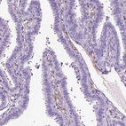 Immunohistochemical staining of human fallopian tube shows negative positivity in glandular cells as expected.