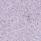 Immunohistochemical staining of human liver shows no positivity in hepatocytes as expected.