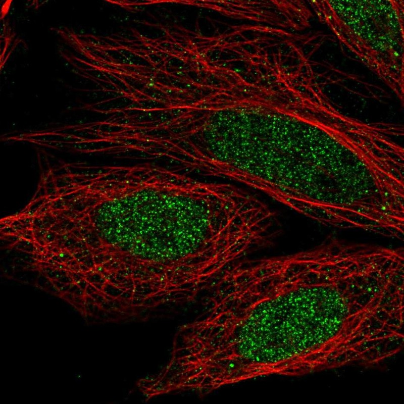 Anti-CCDC36 Antibody