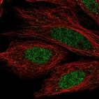 Anti-CCDC36 Antibody