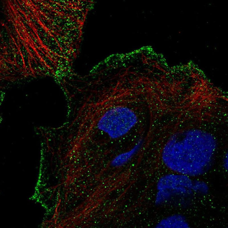 Anti-TRPV3 Antibody