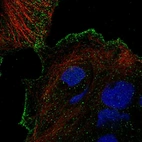 Anti-TRPV3 Antibody