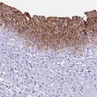 Immunohistochemical staining of human urinary bladder shows high expression.