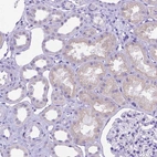 Immunohistochemical staining of human kidney shows low expression as expected.