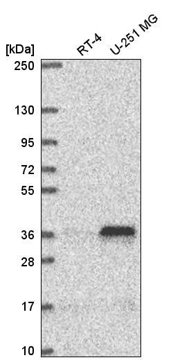 Anti-MTERF1 Antibody
