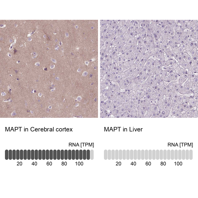 Anti-MAPT Antibody