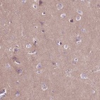 Immunohistochemical staining of human cerebral cortex shows high expression.