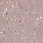 Immunohistochemical staining of human cerebral cortex shows weak cytoplasmic positivity in neuropil.