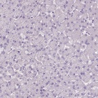 Immunohistochemical staining of human liver shows low expression as expected.