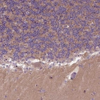 Immunohistochemical staining of human cerebellum shows moderate cytoplasmic positivity in neuropil.