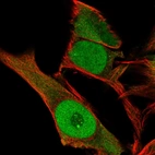 Immunofluorescent staining of human cell line SK-MEL-30 shows localization to nucleus, nucleoli & cytosol.