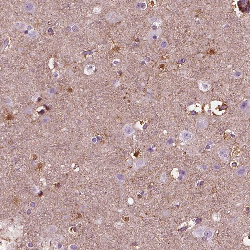 Anti-GDF11 Antibody