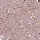 Anti-GDF11 Antibody