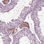 Immunohistochemical staining of human testis shows moderate cytoplasmic positivity in Leydig cells.