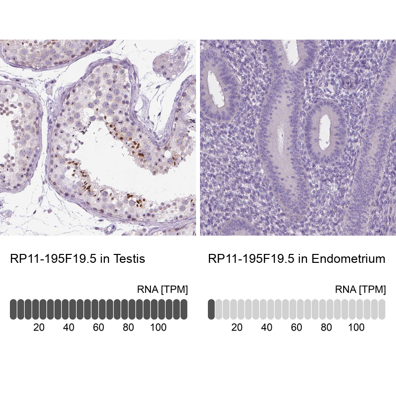 Anti-RP11-195F19.5 Antibody