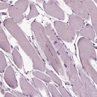 Immunohistochemical staining of human skeletal muscle shows no positivity in myocytes as expected.