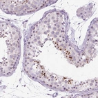 Immunohistochemical staining of human testis shows high expression.