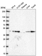 Western blot analysis in human cell line RT-4, human cell line U-251 MG, human plasma, human liver tissue and human tonsil tissue.