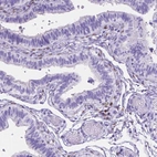 Immunohistochemical staining of human fallopian tube shows moderate nuclear positivity in stromal cells.