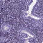 Immunohistochemical staining of human endometrium shows weak nuclear positivity in cells in endometrial stroma.