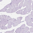 Immunohistochemical staining of human skeletal muscle shows no positivity in myocytes.