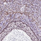 Immunohistochemical staining of human ovary shows moderate nuclear positivity in follicle and stromal cells.