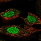 Immunofluorescent staining of human cell line SiHa shows localization to nucleus & cytokinetic bridge.