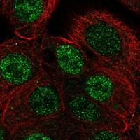 Anti-ANP32B Antibody