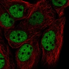 Immunofluorescent staining of human cell line HaCaT shows localization to nucleoplasm.