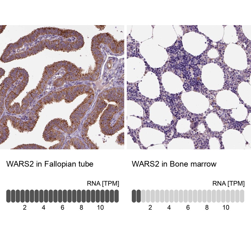 Anti-WARS2 Antibody