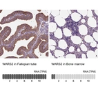 Anti-WARS2 Antibody