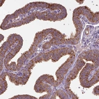 Immunohistochemical staining of human fallopian tube shows strong positivity in cytoplasm granular in glandular cells.
