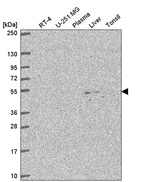 Anti-C3orf67 Antibody