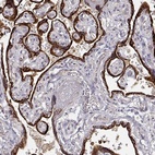 Anti-ARHGAP8 Antibody