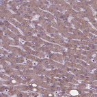 Anti-FAM114A1 Antibody