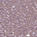 Anti-FAM114A1 Antibody