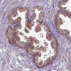 Immunohistochemical staining of human prostate shows moderate cytoplasmic positivity in glandular cells.