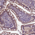 Immunohistochemical staining of human small intestine shows moderate cytoplasmic positivity in glandular cells.