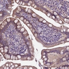Immunohistochemical staining of human small intestine shows moderate cytoplasmic positivity in glandular cells.