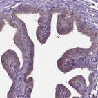 Immunohistochemical staining of human fallopian tube shows weak cytoplasmic positivity in glandular cells.