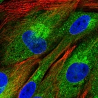 Immunofluorescent staining of human cell line BJ shows localization to cytosol & the Golgi apparatus.