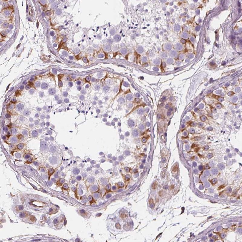 Anti-PGAP1 Antibody
