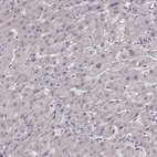 Immunohistochemical staining of human liver shows no positivity in hepatocytes as expected.