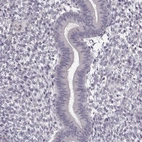 Immunohistochemical staining of human endometrium shows no positivity in glandular cells as expected.