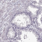 Immunohistochemical staining of human prostate shows no positivity in glandular cells as expected.