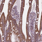 Anti-PYCRL Antibody