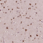 Immunohistochemical staining of human cerebral cortex shows moderate nuclear positivity in neurons.