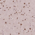Immunohistochemical staining of human cerebral cortex shows moderate nuclear positivity in neurons.